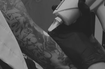 Sesión de eliminación de tatuaje con láser